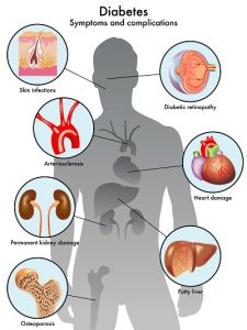 Image of symptoms and complications of diabetes